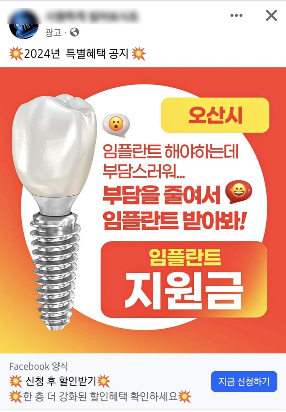 이권재 오산시장이 최근 각종 SNS에 퍼지고 있는 “오산시민이라면 무료”라는 미끼 광고에 주의를 당부하고 나섰다. 실제로 각종 SNS에는 오산시민들을 대상으로 하는 각종 미끼광고가 기승을 부리고 있어 각별한 주의가 요구된다. (사진=이권재 오산시장 페이스북)