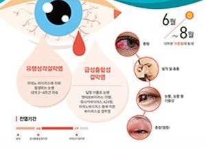 오산시보건소, 휴가철 유행성 눈병 주의 당부
