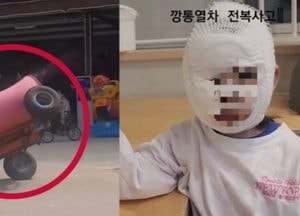 놀이기구 뒤집혀 어린 쌍둥이 얼굴 2도 화상