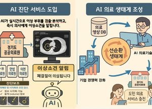 경기도, AI가 의료 영상 판독하고 진단 보조...수원·안성·이천 공공의료원에 ‘AI 진단보조시스템’ 도입