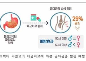 헬리코박터 제균 치료, 골다공증 예방 효과 확인